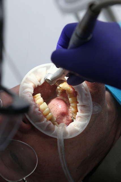 zubní zákrok